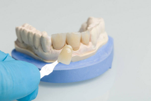 Nhiều người lầm tưởng răng sứ mỏng nên dễ bong và hư hỏng