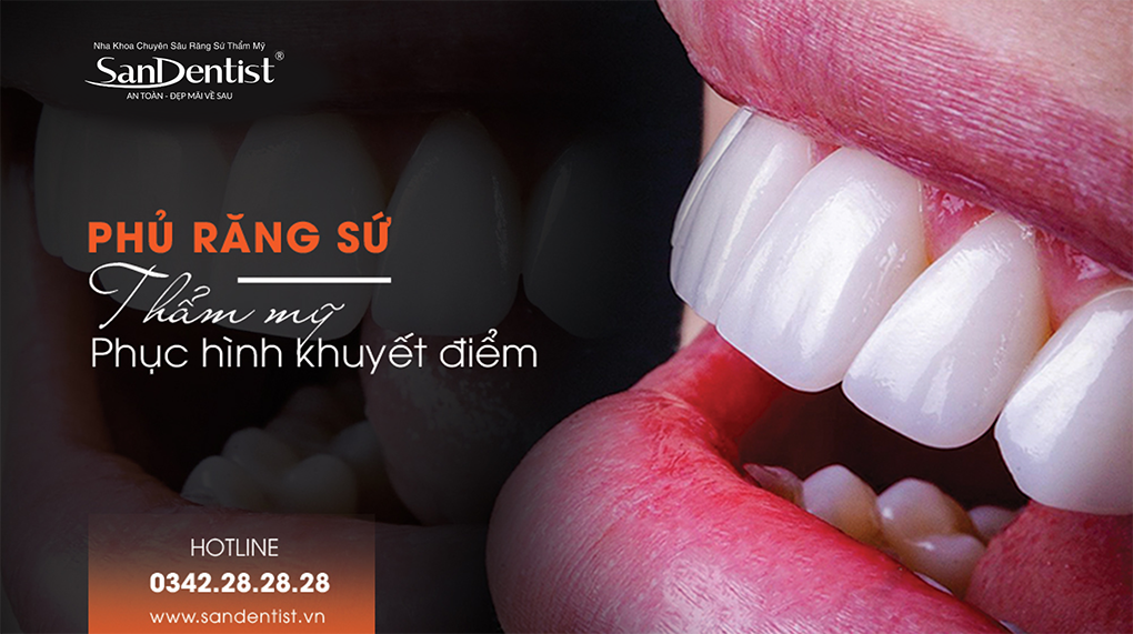 Phủ răng sứ thẩm mỹ