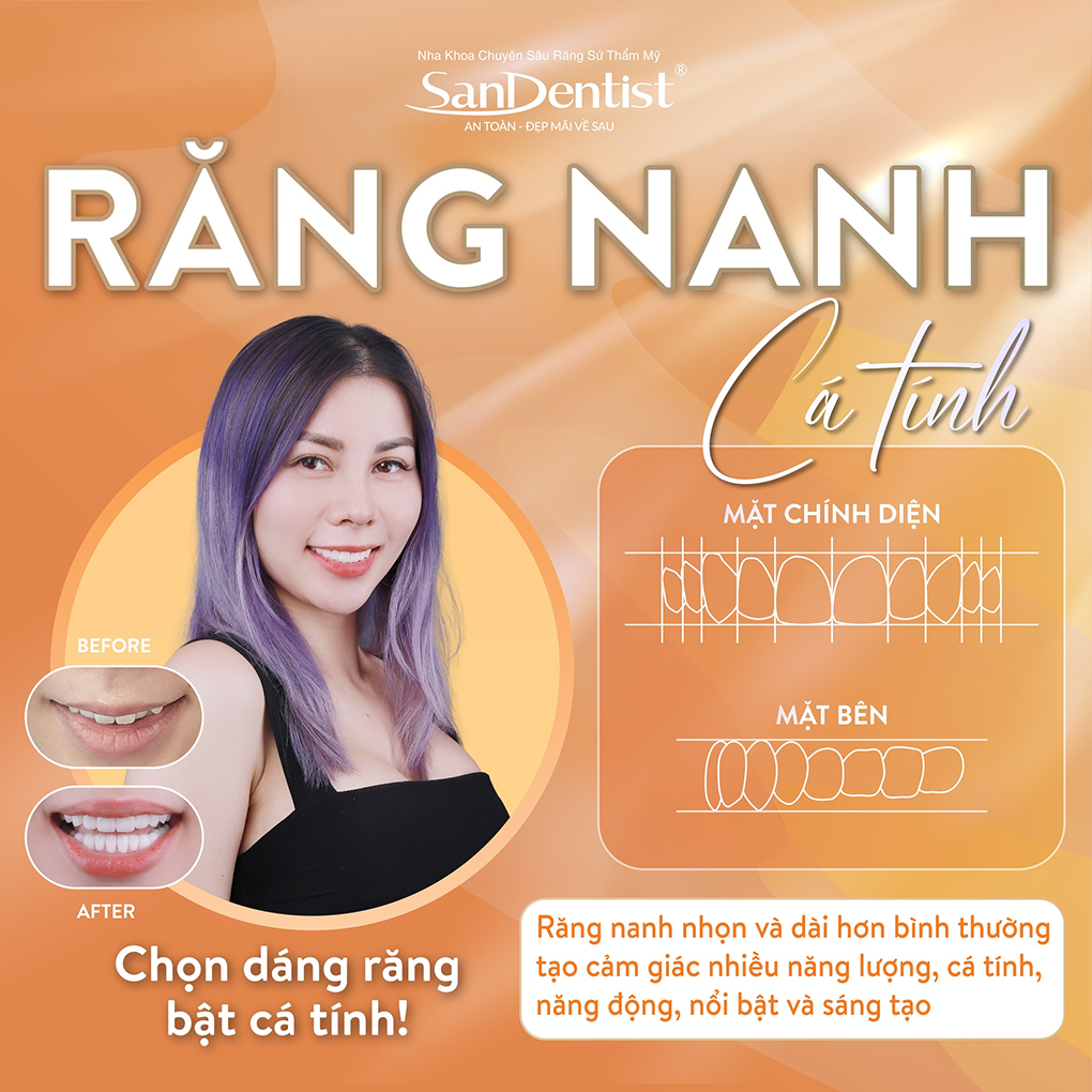 Dáng răng nanh nổi bật cá tính