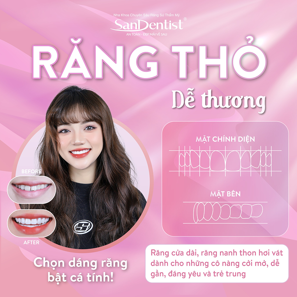 Dáng răng thỏ thể hiện sự dễ thương