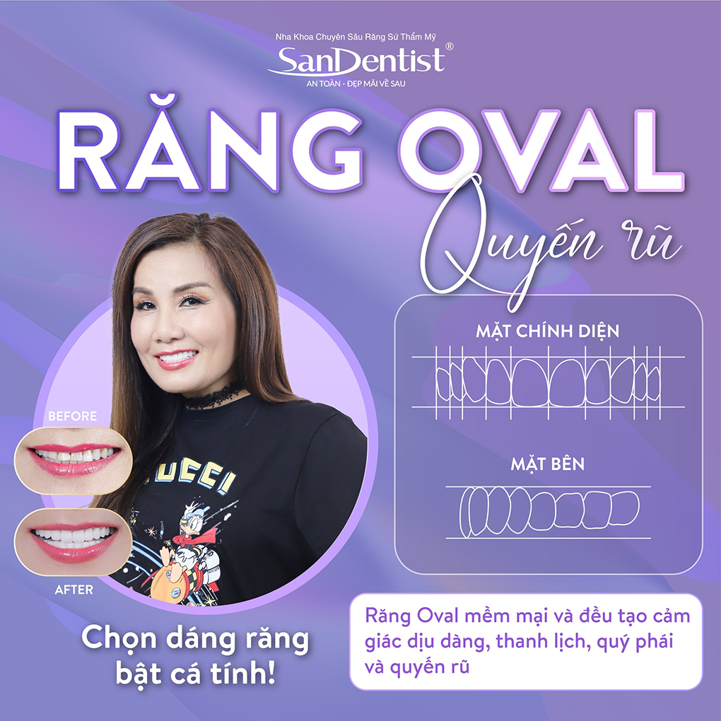 Dáng răng Oval thể hiện sự quyến rũ