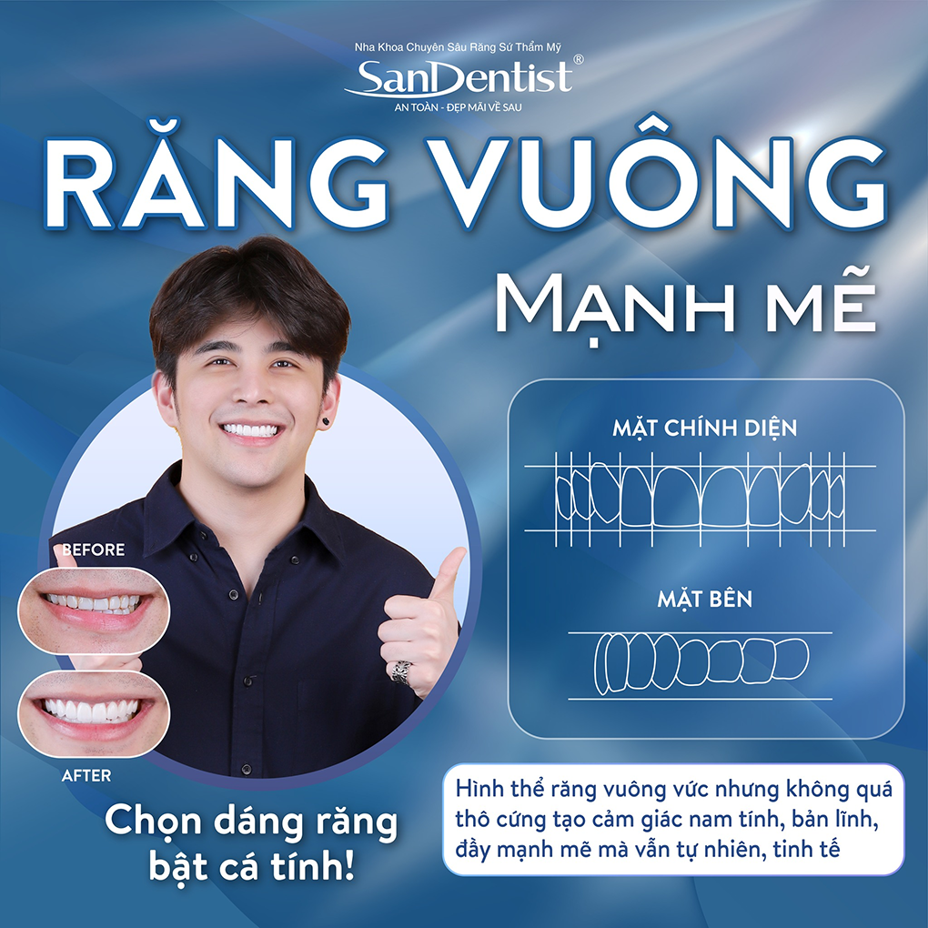 Dáng răng vuông nổi bật sự mạnh mẽ