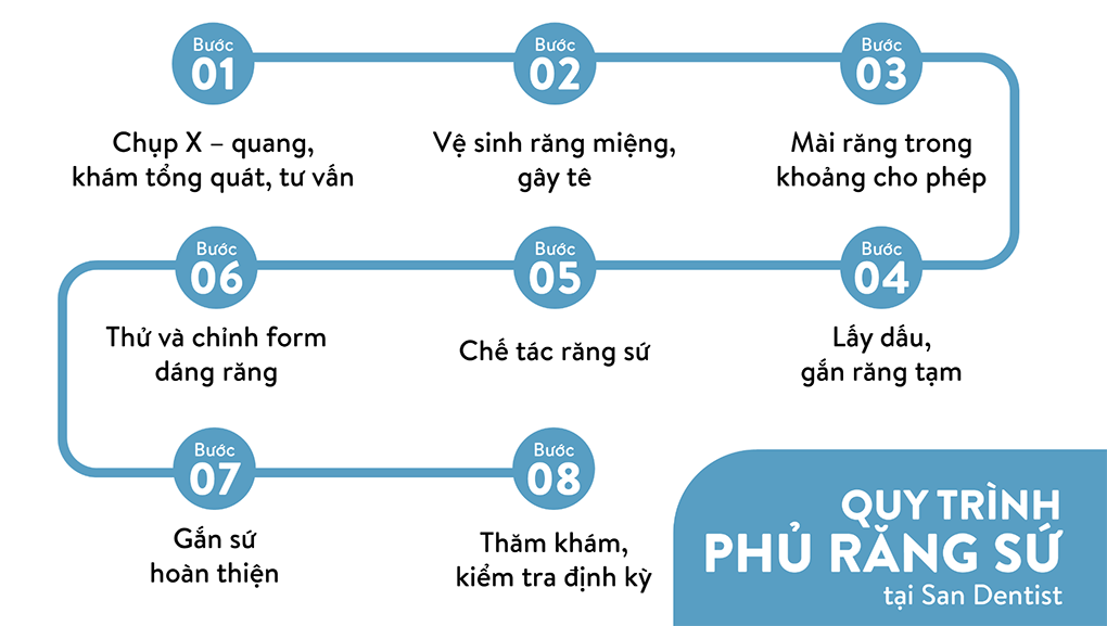 08 bước phủ răng sứ thẩm mỹ chuẩn y khoa tại San Dentist