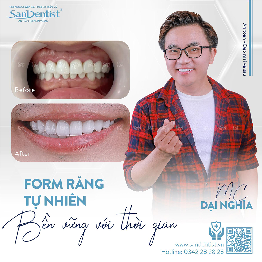 San Dentist là địa chỉ được nhiều khách hàng tin tưởng “chọn mặt gửi vàng”.