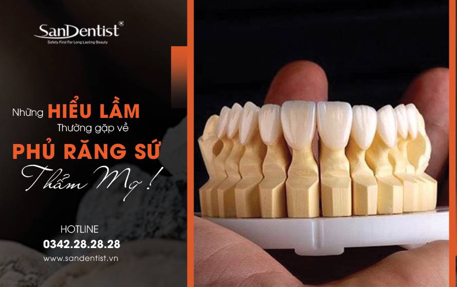Những hiểu lầm về phủ răng sứ thẩm mỹ phổ biến nhất!