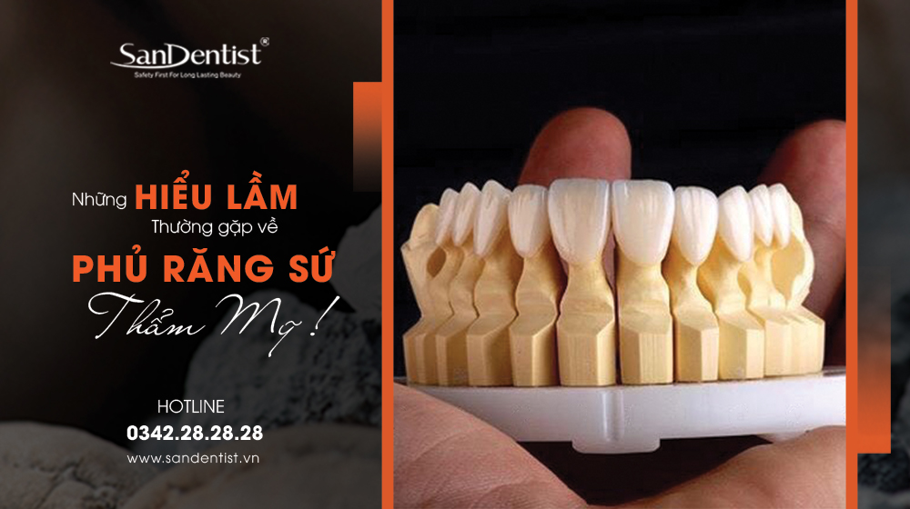 Những hiểu lầm về phủ răng sứ thẩm mỹ phổ biến nhất!
