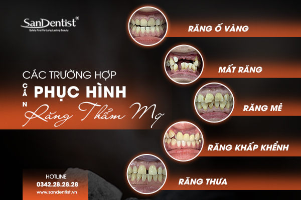Các trường hợp cần phục hình răng thẩm mỹ