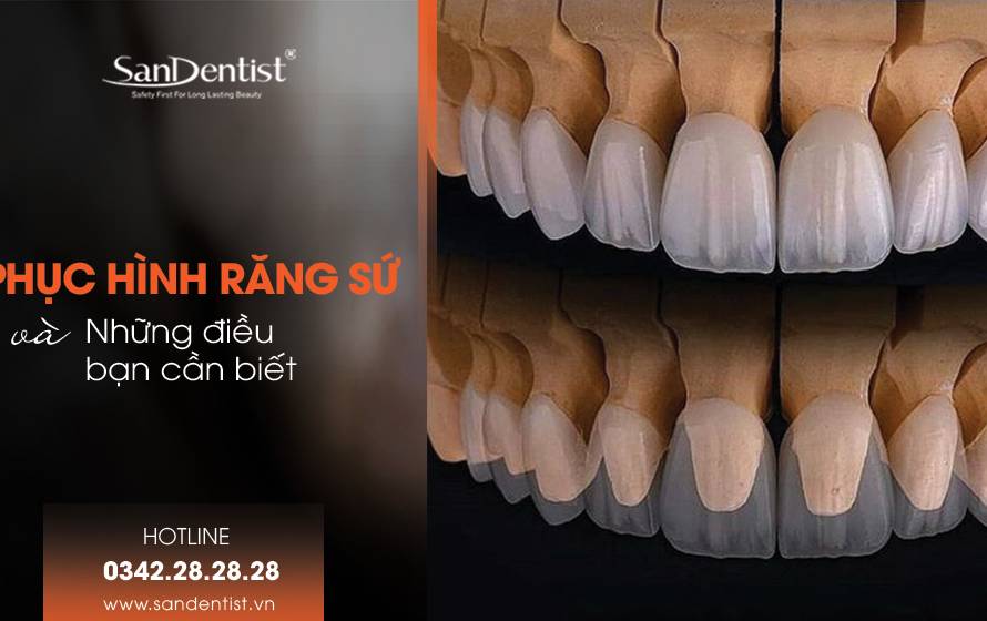Phục hình răng sứ và những điều bạn cần biết!