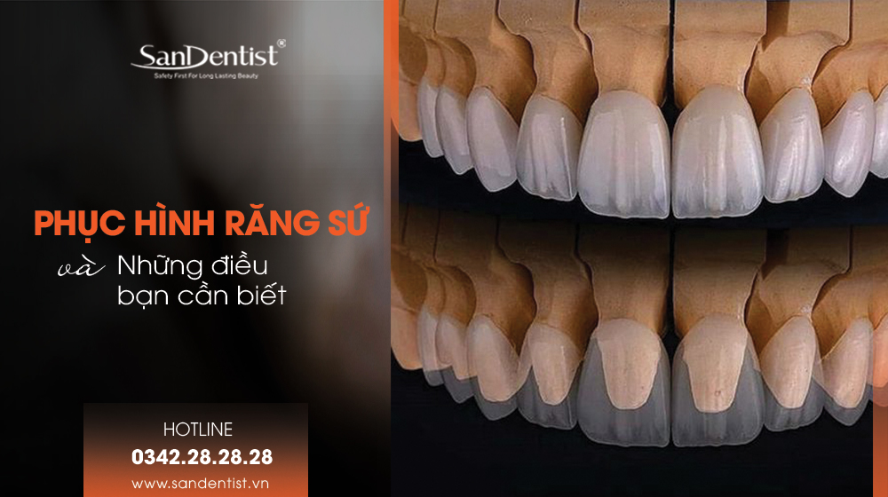 Phục hình răng sứ và những điều bạn cần biết!