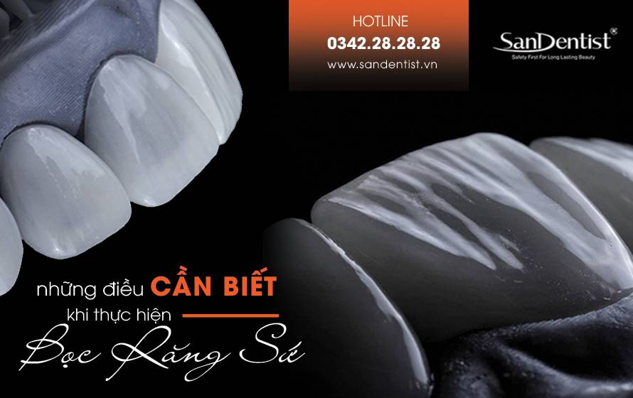 Tất tần tật những điều cần biết khi thực hiện phủ răng sứ