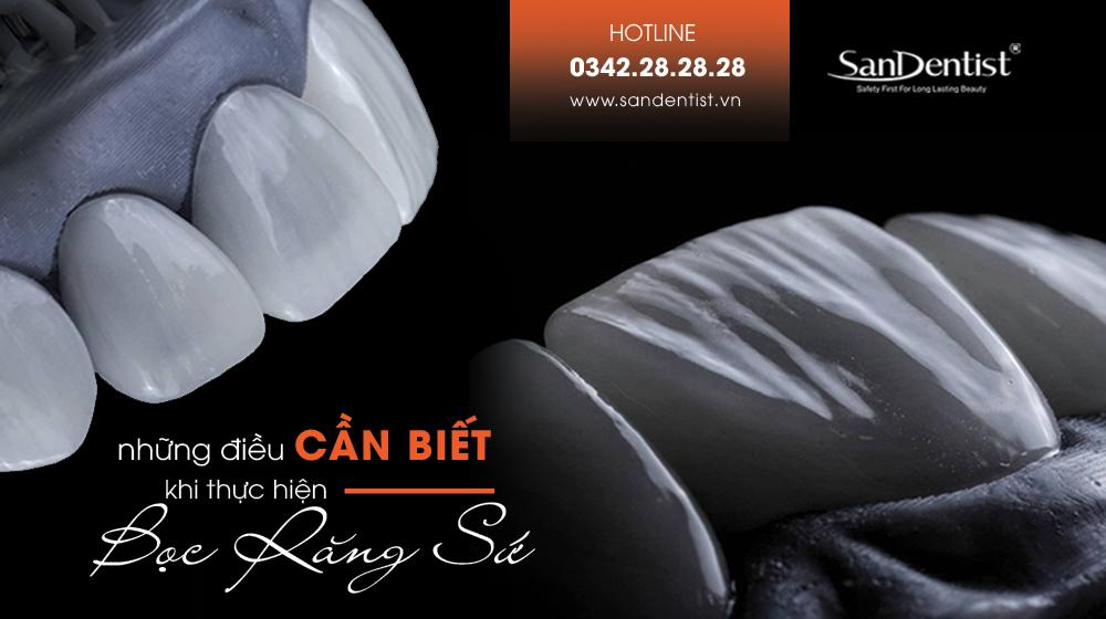 Tất tần tật những điều cần biết khi thực hiện phủ răng sứ